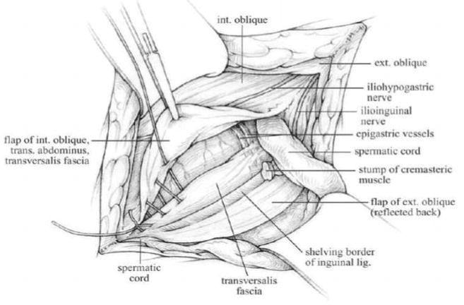 Groin Muscle Anatomy - inguinal ligament ct - ModernHeal.com - Groin