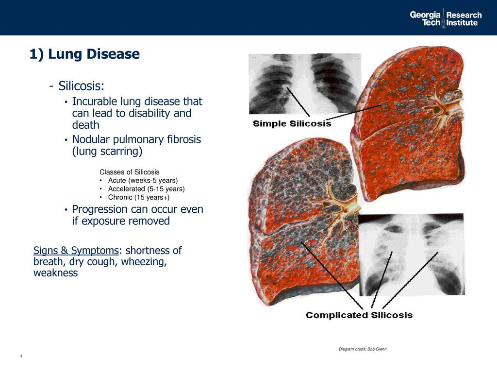 Copd Oxygen Level 97 - Hirup j