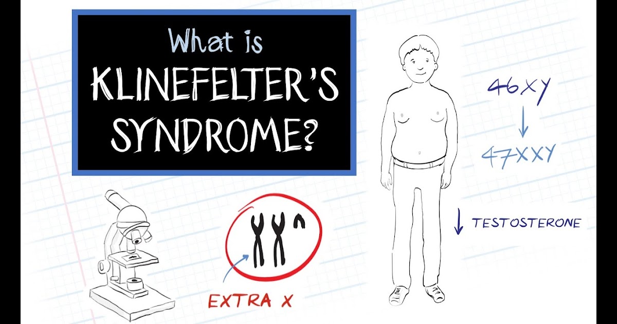 What Is Klinefelter S Syndrome Dorothy S List