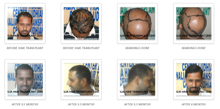 hair-gallery-img4