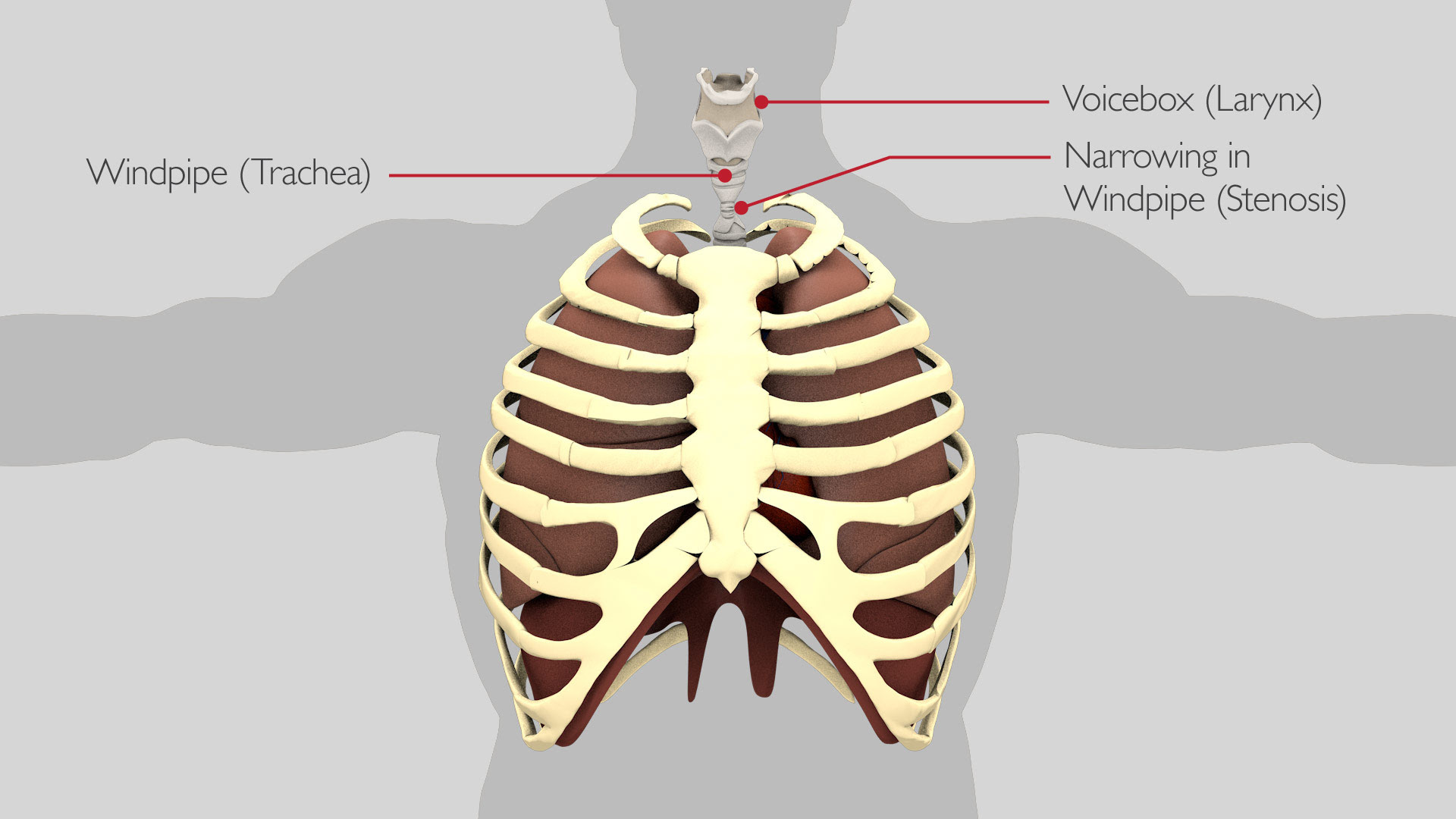 Help For Copd Emphysema - Hirup a