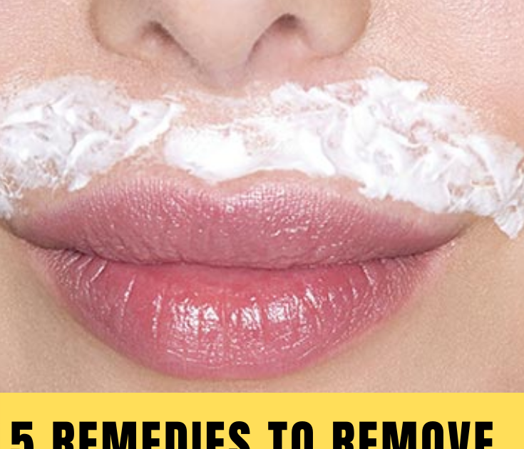 How To Remove Blackhead From Upper Lip Howtoremvo