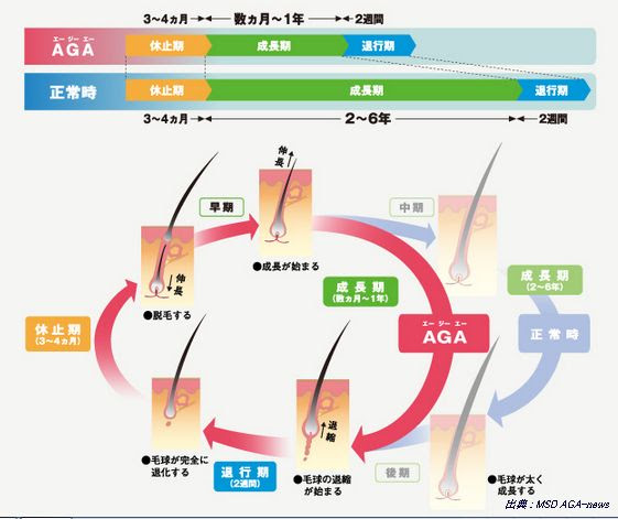 最新のファッション これまでで最高の女性 ホルモン 毛