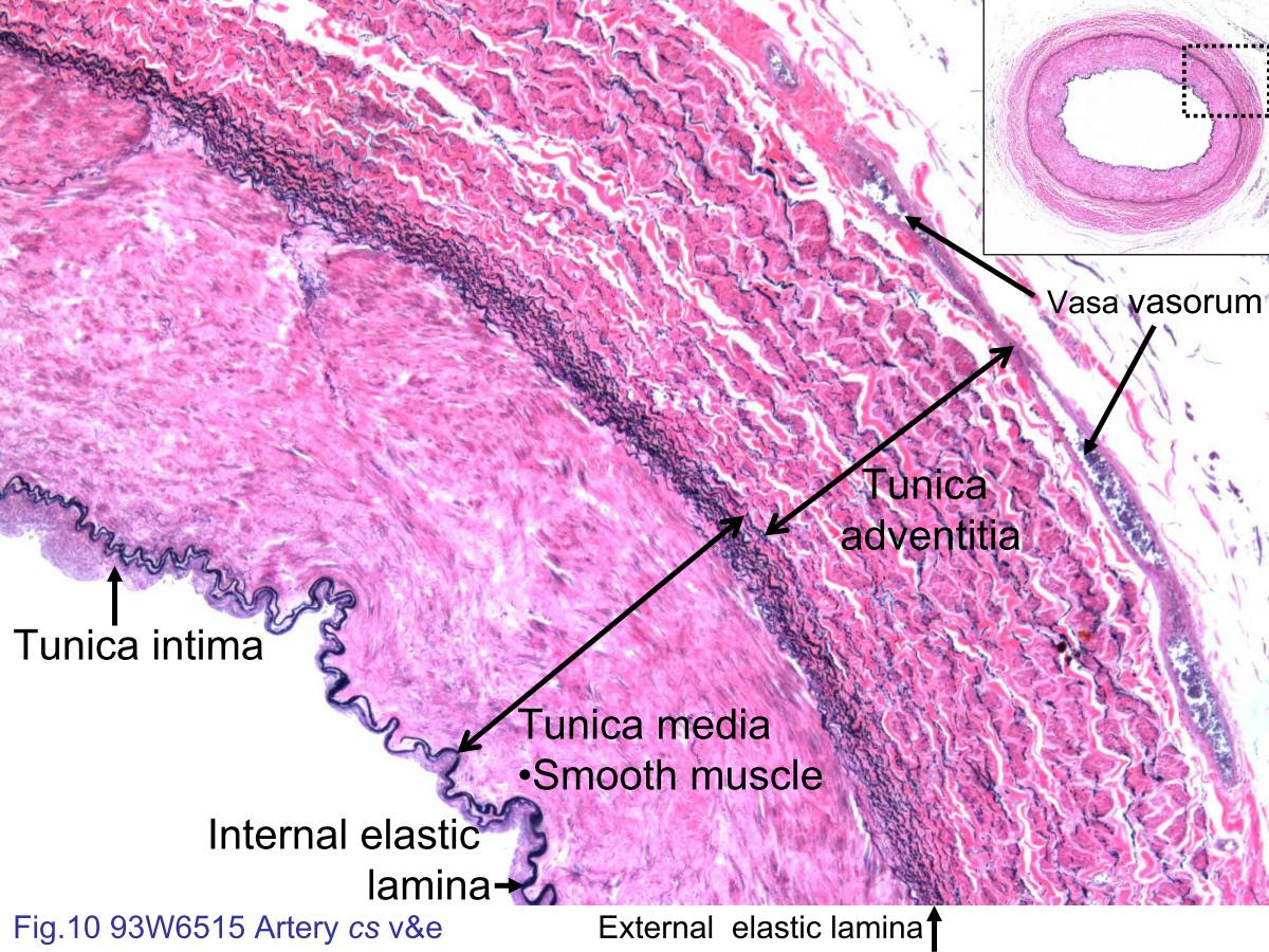 Срез сосуда. Артерия эластического типа гистология. Артерия мышечного типа препарат гистология. Строение артерии эластического типа гистология. Артерия эластического типа препарат гистология.