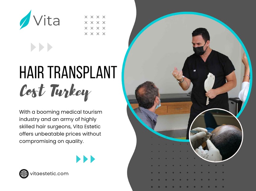 Hair Transplant Cost Turkey