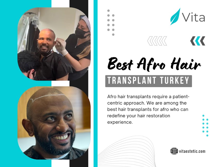 Best Afro Hair Transplant Turkey