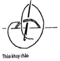 Cách Thùa Khuy-Đính Nút Trong May Mặc 4