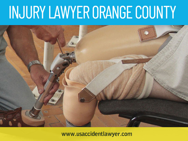 Injury Lawyer Orange County