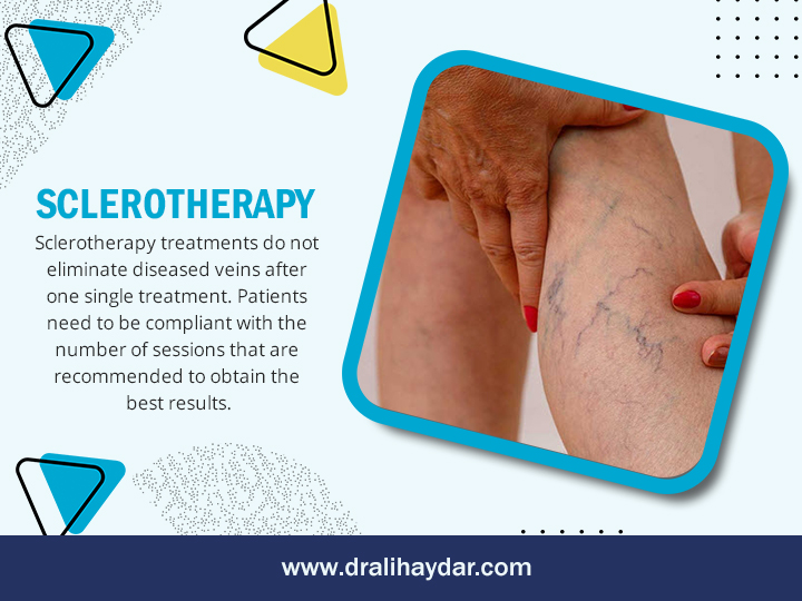 Sclerotherapy Qatar