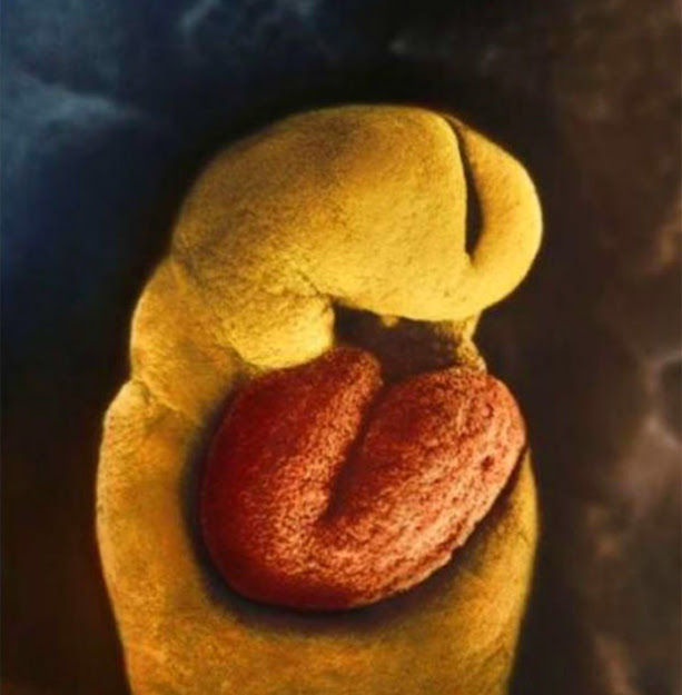 Incredible Photos of a Baby Developing in the Womb