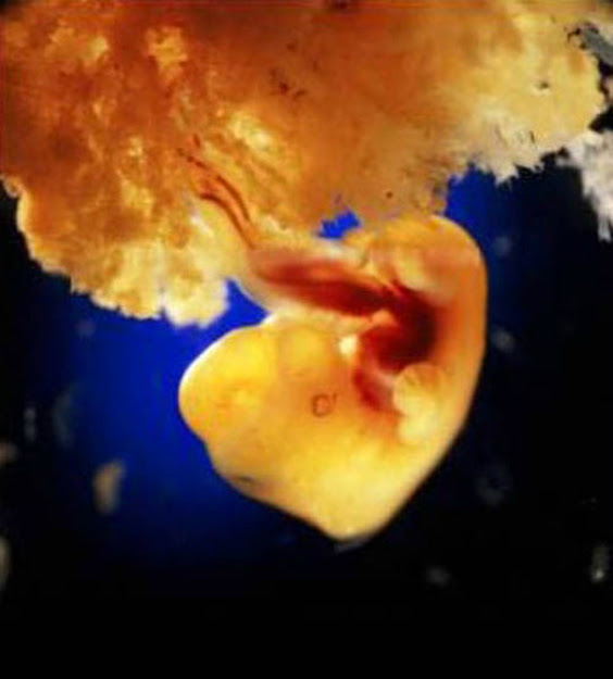 Incredible Photos of a Baby Developing in the Womb