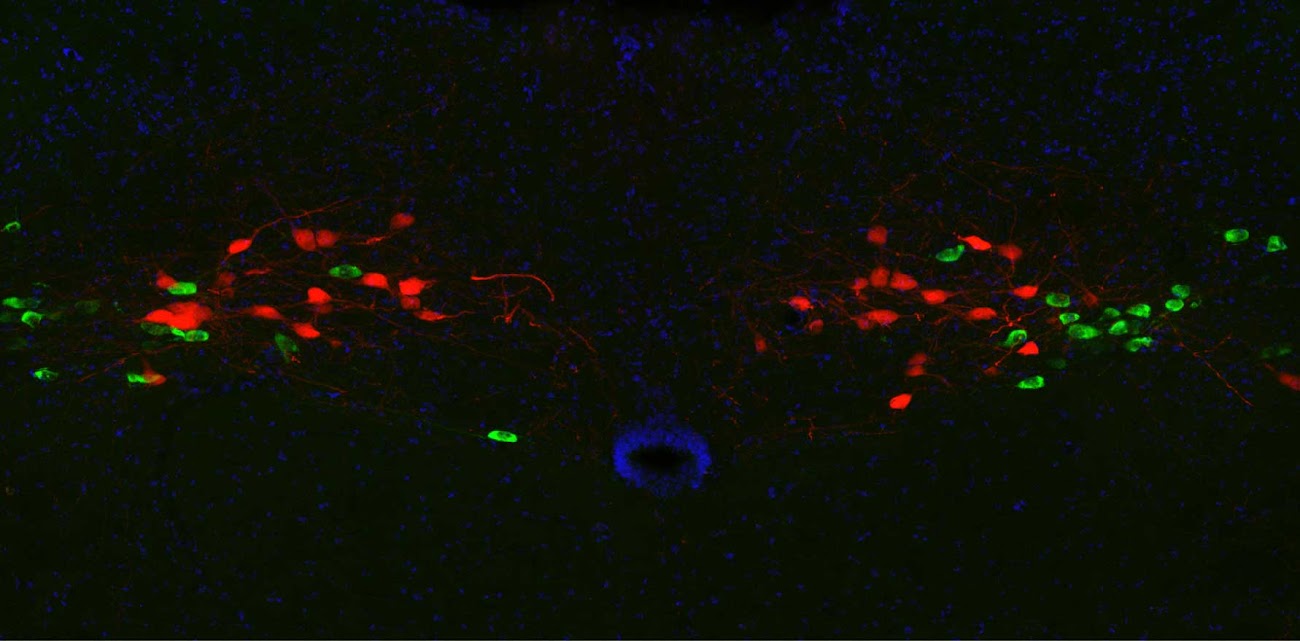 Foto de microscopia de neurônios iluminados em verde e vermelho