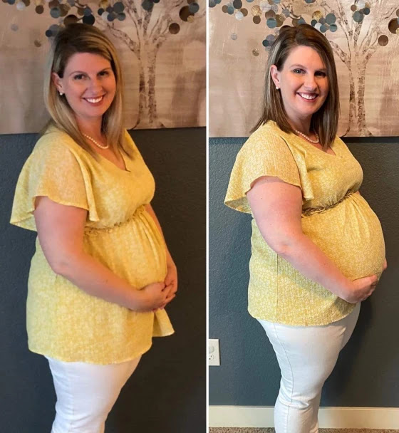 After Surprise Triplet Pregnancy, Couple Stunned By Another One