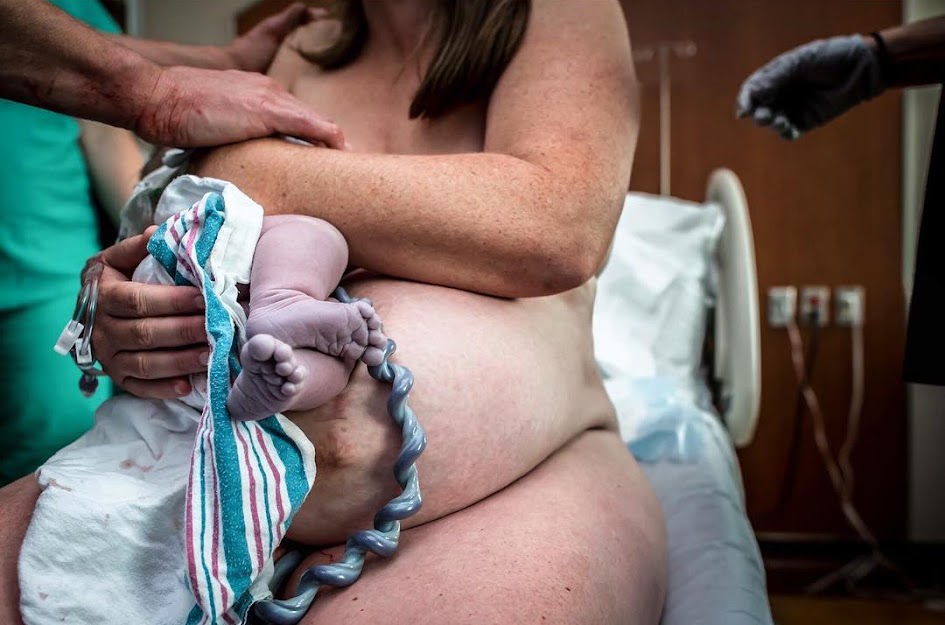 15 Birth Photos That Change the Way We See Umbilical Cords