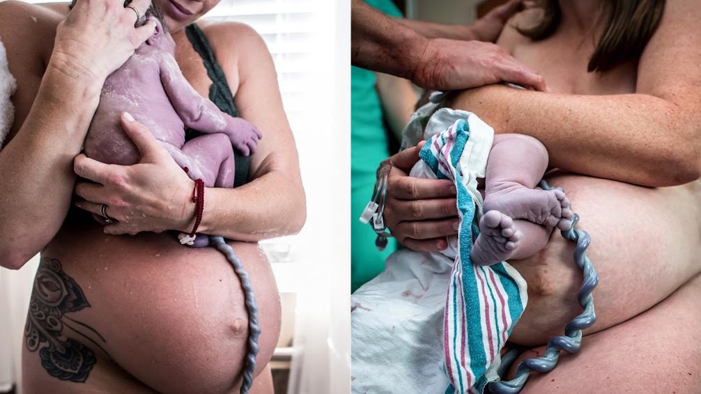 15 Birth Photos That Change the Way We See Umbilical Cords