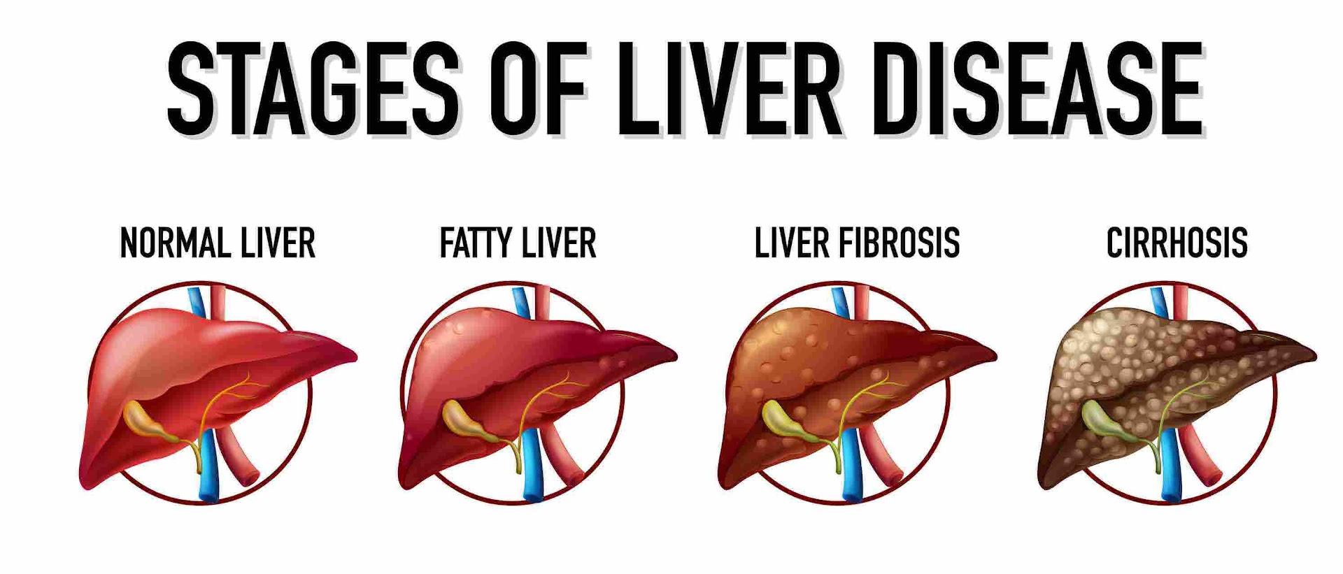 Libaver Bharata Obat Liver