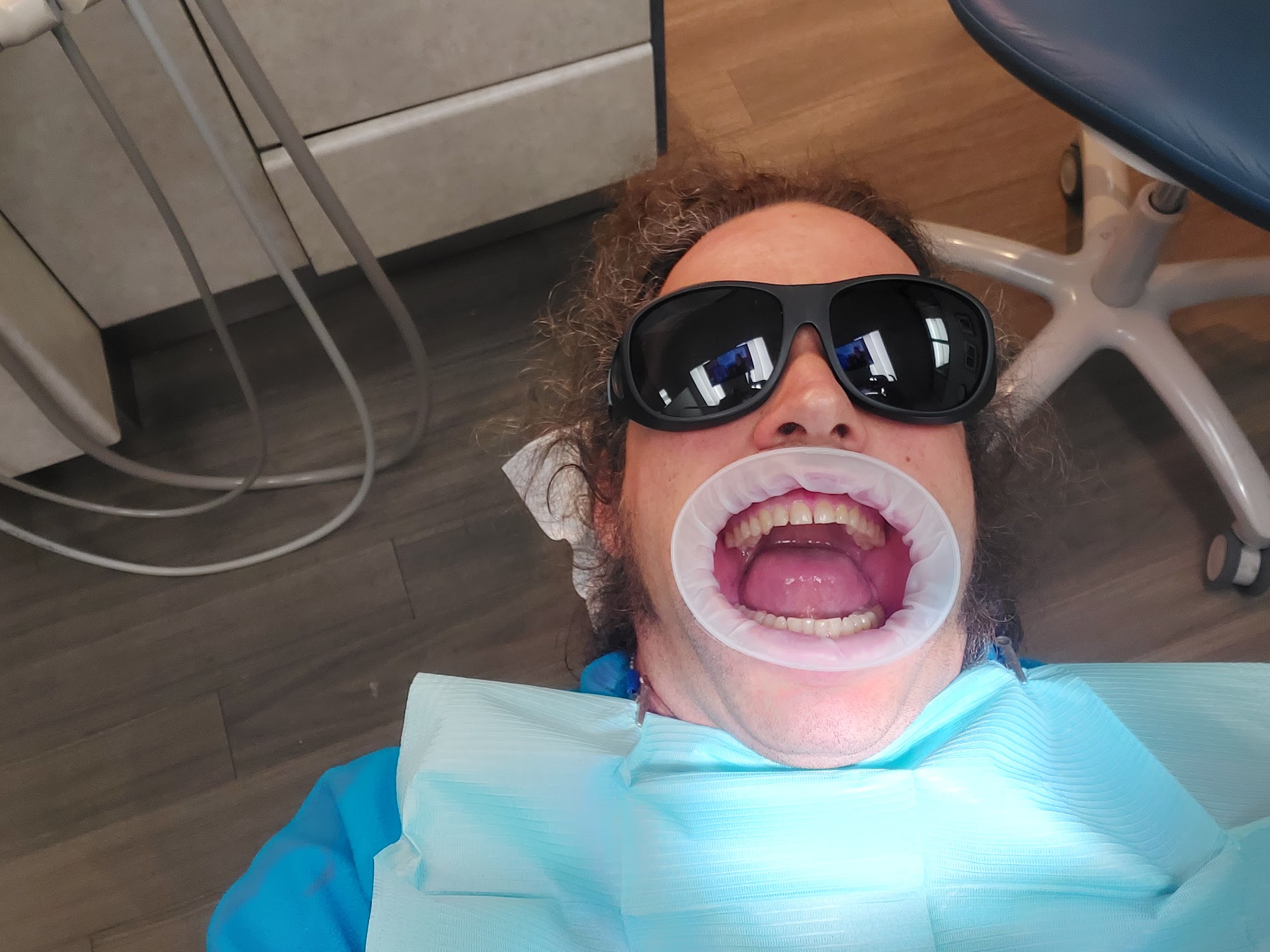 Me on dental chair with mouth spread by Optragate