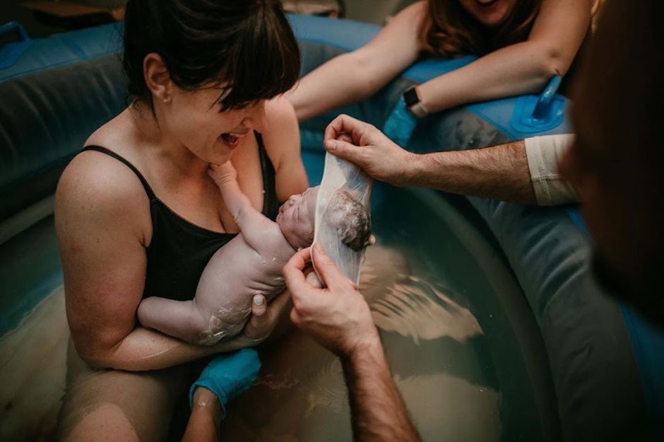 En Caul Births: 25 Rare Photos of Babies Born in the Amniotic Sac