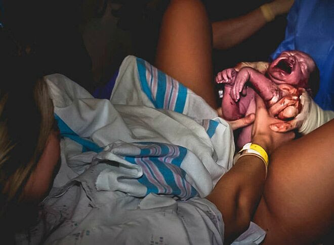 15 Incredible and Powerful Photos Of Moms 'Delivering' Their Own Babies