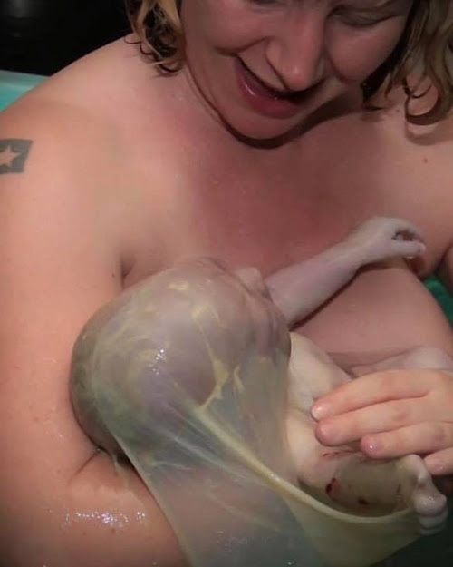 En Caul Births: 25 Rare Photos of Babies Born in the Amniotic Sac