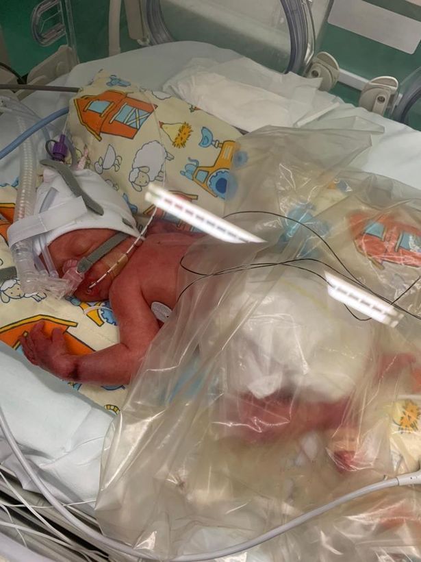 Scots Twin Babies Defy The Odds After Being Born Three Months Premature