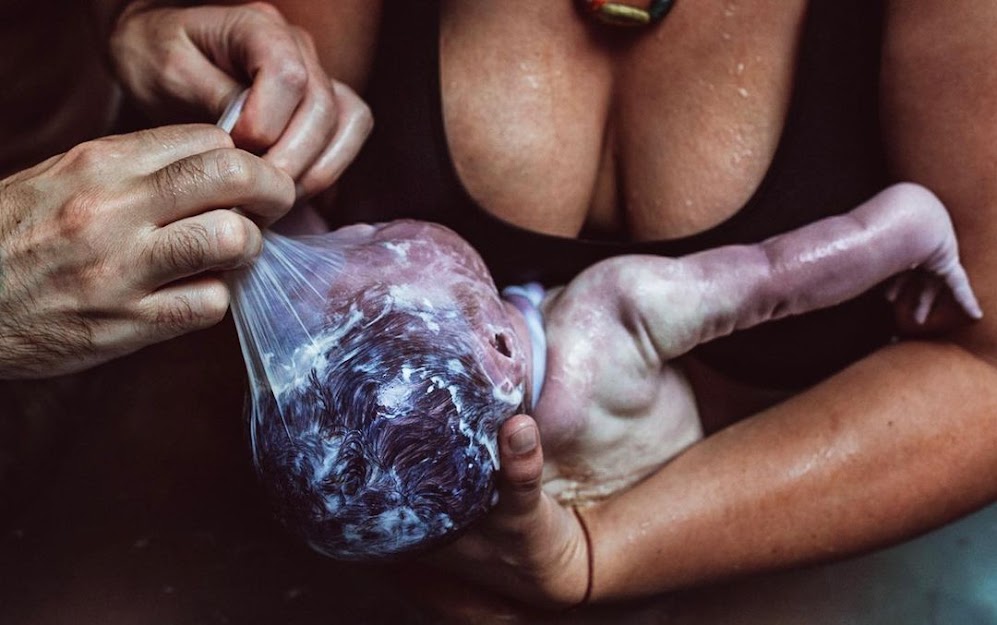 En Caul Births: 25 Rare Photos of Babies Born in the Amniotic Sac