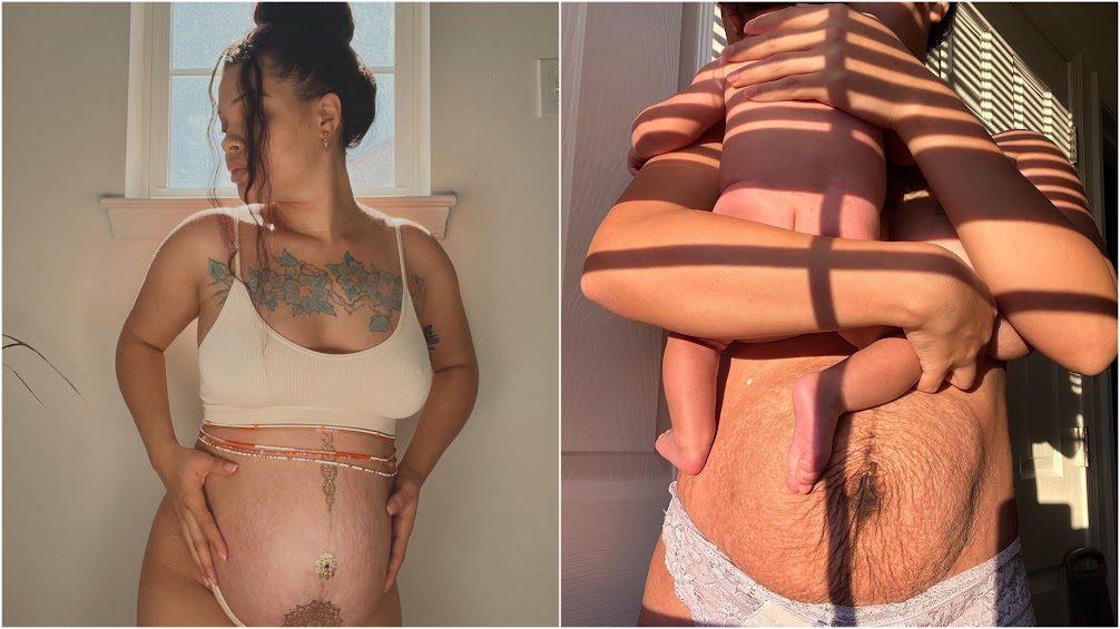 Mom Sharing Postpartum Body To Take On Society’s Ridiculous Expectations