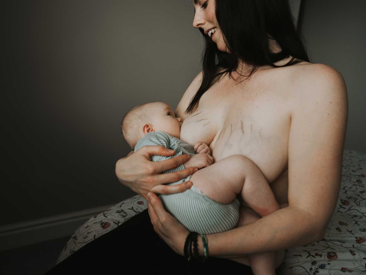 Photographer Rejoices Mothers’ Stretch Marks, Scars In Gorgeous Gold Dust Project