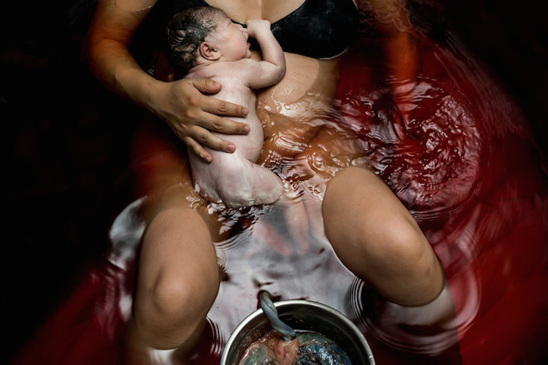 30 Of The Most Beautiful Moments in Birth Photography