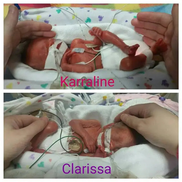 Couple Has 3 Sets Of Twins In Less Than 5 Years, But That’s Not The Craziest Part Of This Story