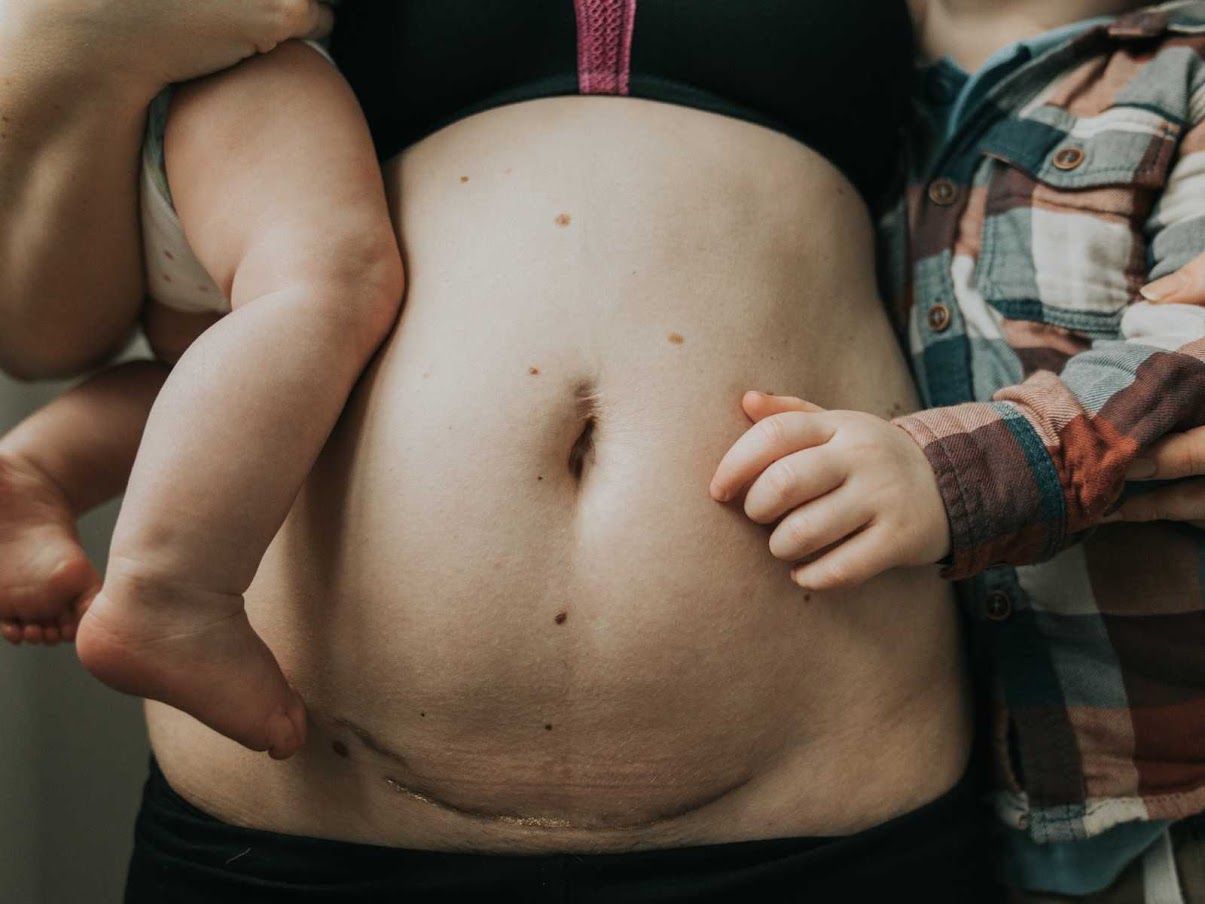 Photographer Rejoices Mothers’ Stretch Marks, Scars In Gorgeous Gold Dust Project