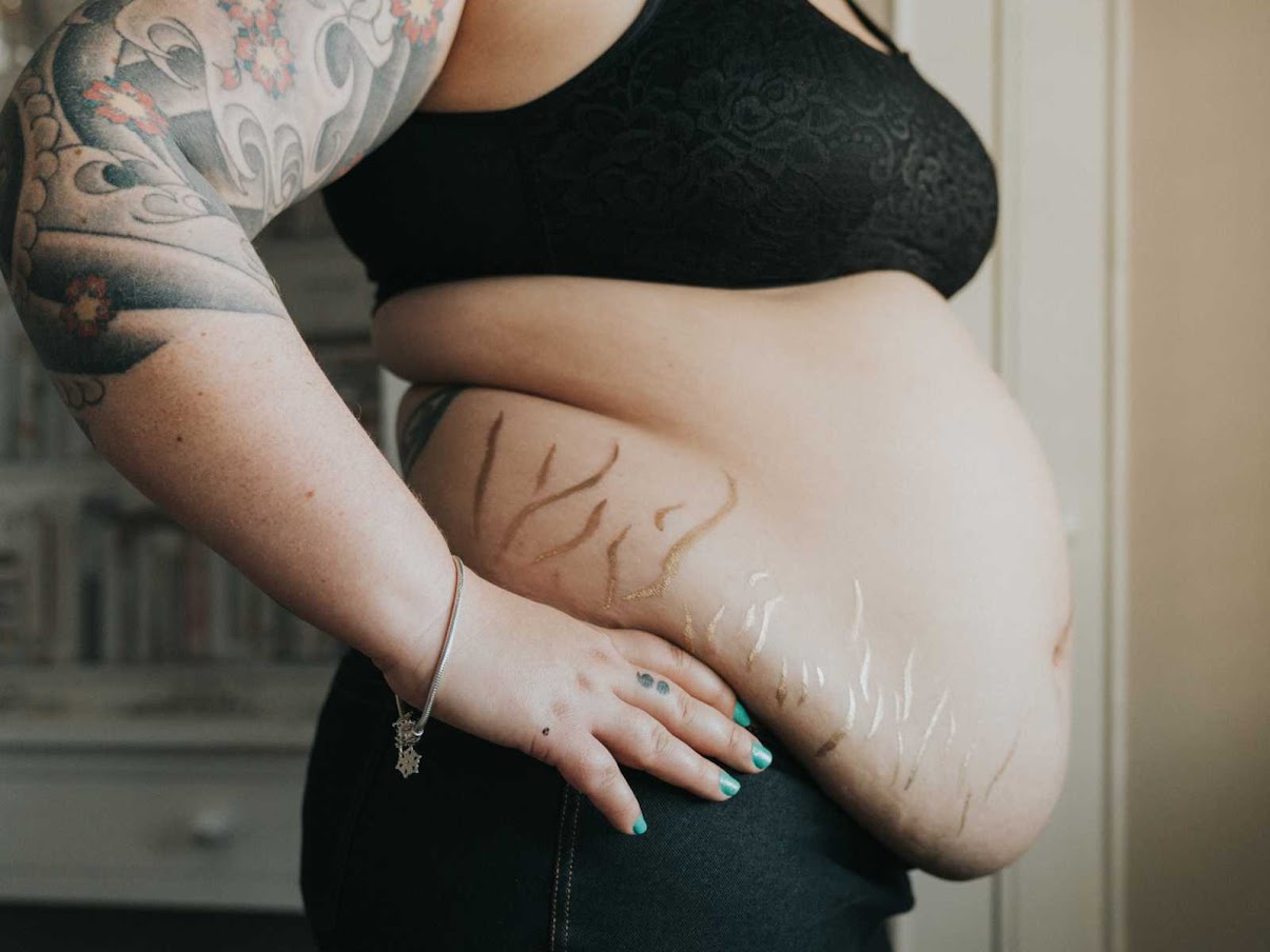 Photographer Rejoices Mothers’ Stretch Marks, Scars In Gorgeous Gold Dust Project