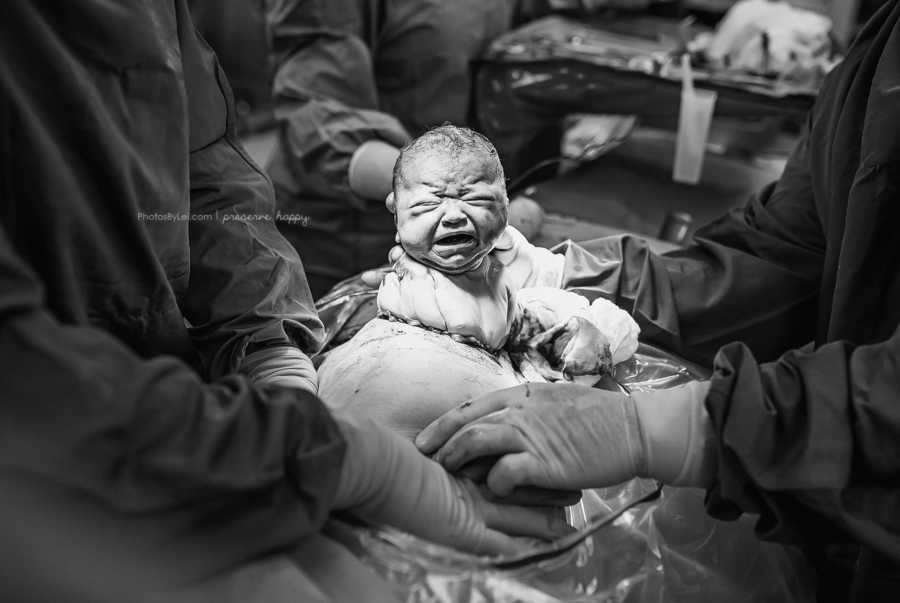 ‘This Too Is Beautiful. This Too Is A Miracle.’: Birth Photographer Empowers C-Section Moms To Realize Their Births Are Not ‘Diminished, Reduced’