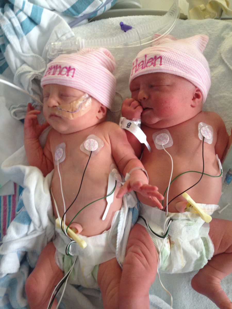 Mom Births Identical Twins