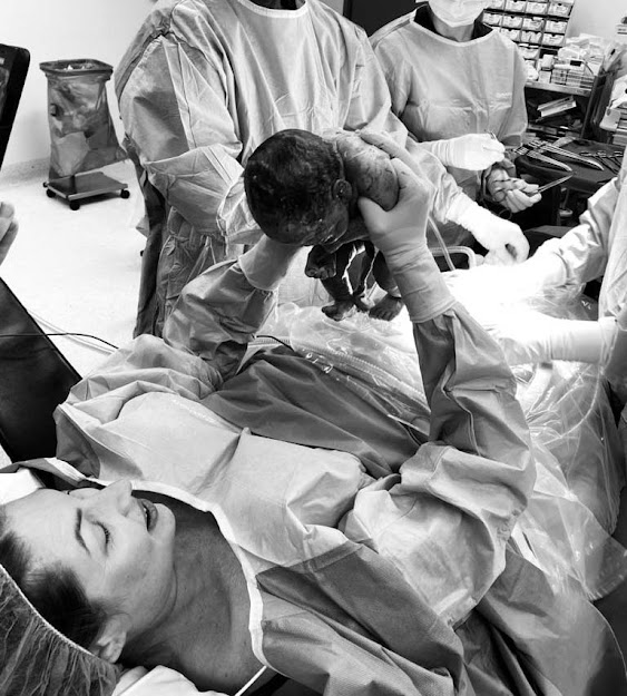 15 Incredible and Powerful Photos Of Moms 'Delivering' Their Own Babies