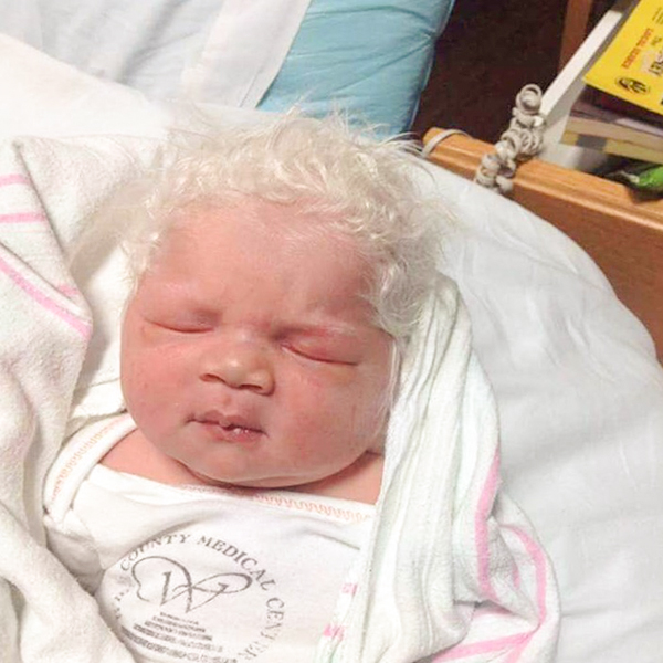 Baby Born With Full Head Of White Hair With Nicknamed  “Prince Charming”