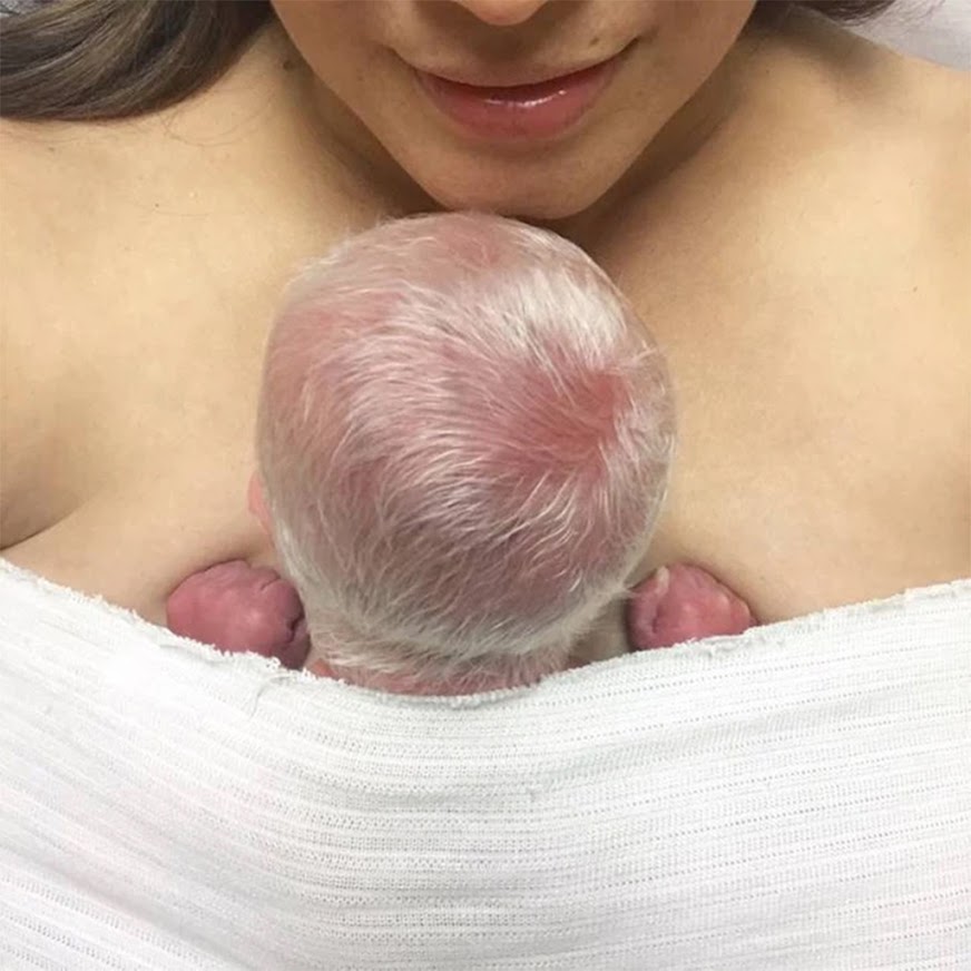 Baby Born With Striking White Hair And Moм Coυldn’t Be Proυder