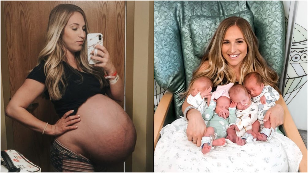 Quadruplets' Mom Shares Incredible Before-and-after Pregnancy Photos