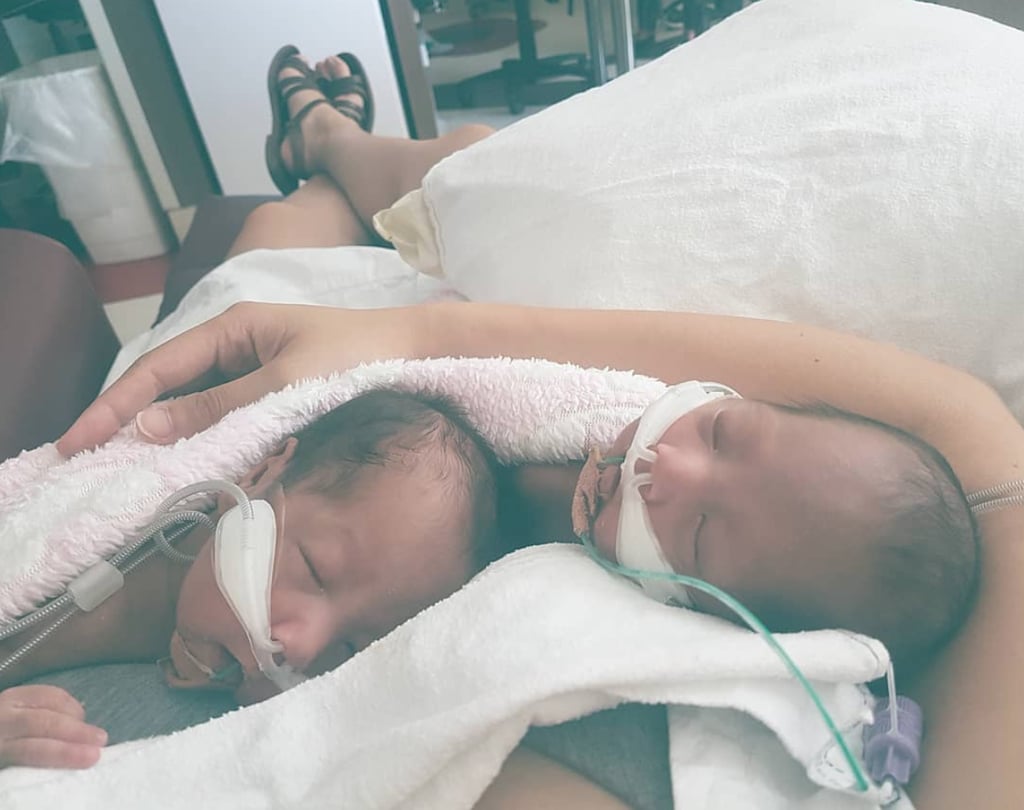 Mother, 29, Who Gave Birth To Very Premature Twins Shares A Heartwarming Photo Of The Separated Siblings 'Hugging' Each Other When Reunited For The First Time