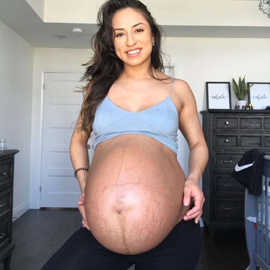 Twins Mom’s Amazing Before-And-After Pregnancy Photos Go Viral