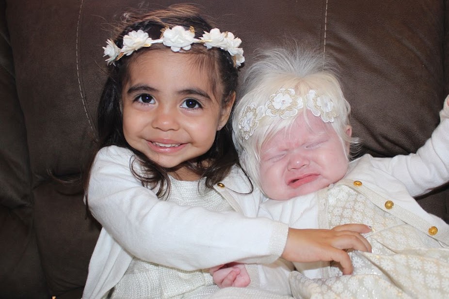 A Latino Parents Are Shocked After Giving Birth To A Blond Baby Girl With Light Skin