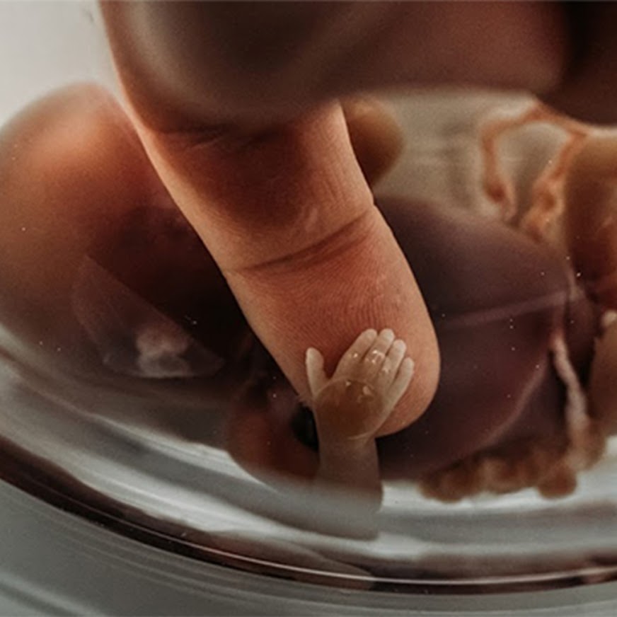 Raw Birth Photos That Capture The Beauty And Power Of Delivery