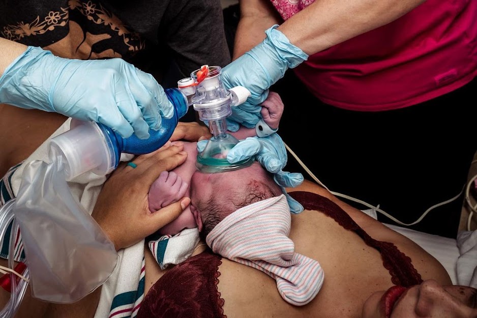 Childbirth is Wild: It Doesn’t Always Go As Planned