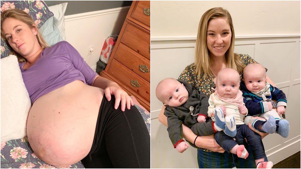 Triplets' Mother Shares Amazing Before & After Pregnancy Photos