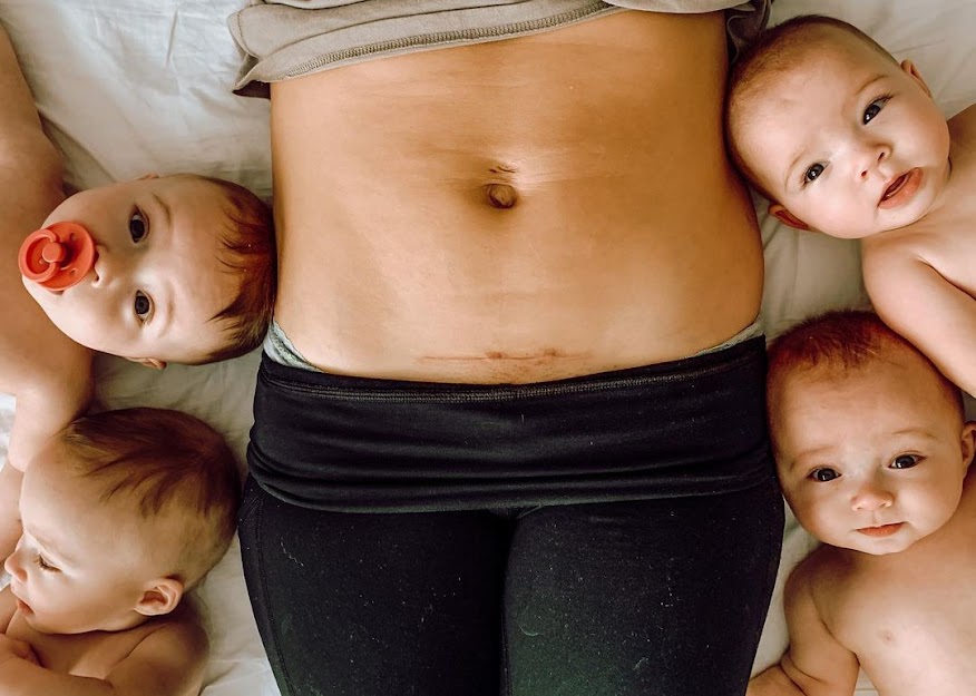 Mom Gives Birth to Quadruplets After 3 Miscarriages