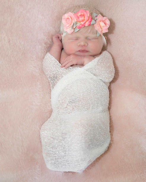 A Latino Parents Are Shocked After Giving Birth To A Blond Baby Girl With Light Skin