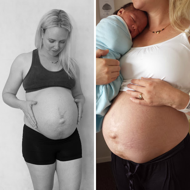 Post-baby Body Photos