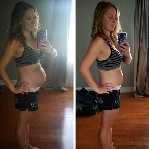 Mother of Two Shares Postpartum Photo to Show ‘Realistic’ Side of Giving Birth