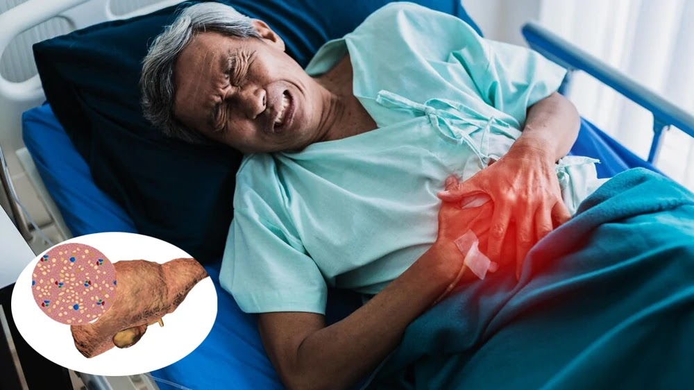 Men gan tăng đột ngột khiến cơ thể gặp nhiều bệnh lý nguy hiểm
