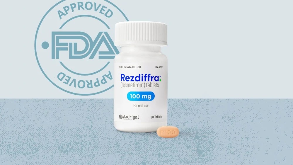 Thuốc đặc trị gan nhiễm mỡ Rezdiffra Hoa Kỳ